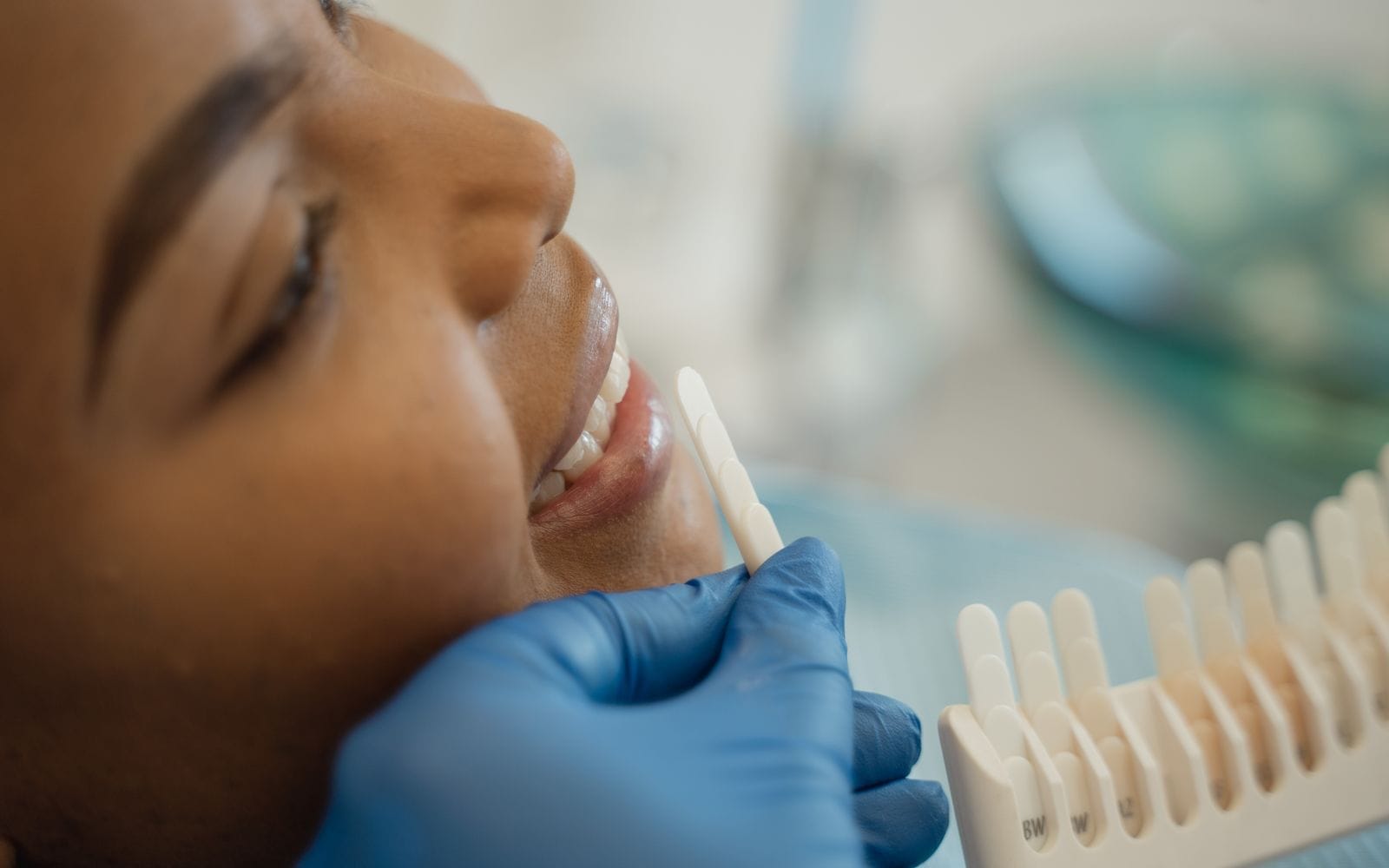 Dentista comparando a cor dos dentes de uma paciente com a escala de cores